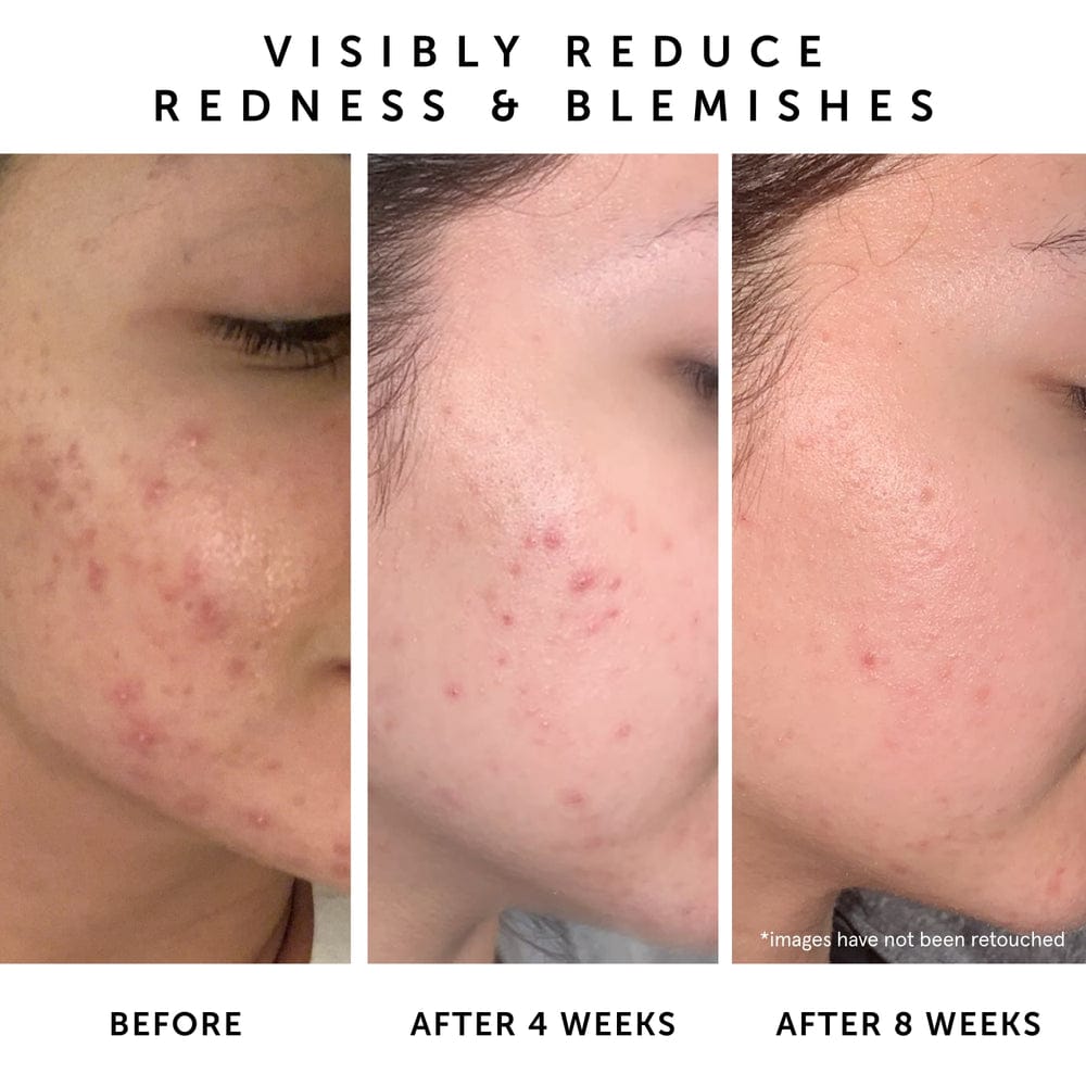 Herbivore Lapis Facial Oil 50ml-media-56643