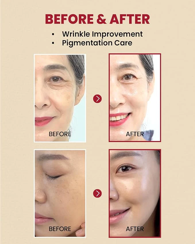 KSecret Retinal Liposome 2% + Black Ginseng Serum -media-52396