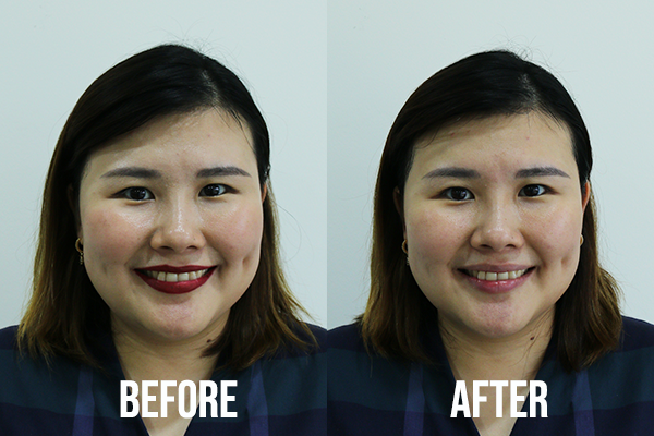 Bioderma Sensibio H2O Micellar Water Makeup Remover-media-52856